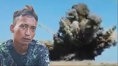 Anjas (26) korban selamat ledakan amunisi di Garut, Jawa Barat. Sumber : Karina/tvOnenews